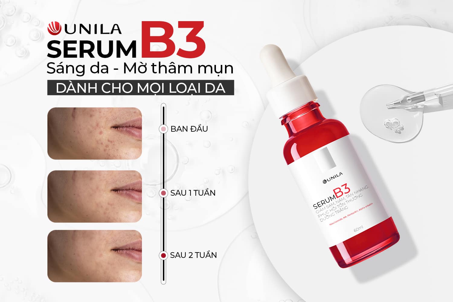 Gia công mỹ phẩm sạch Niacinamide Serum UNILA