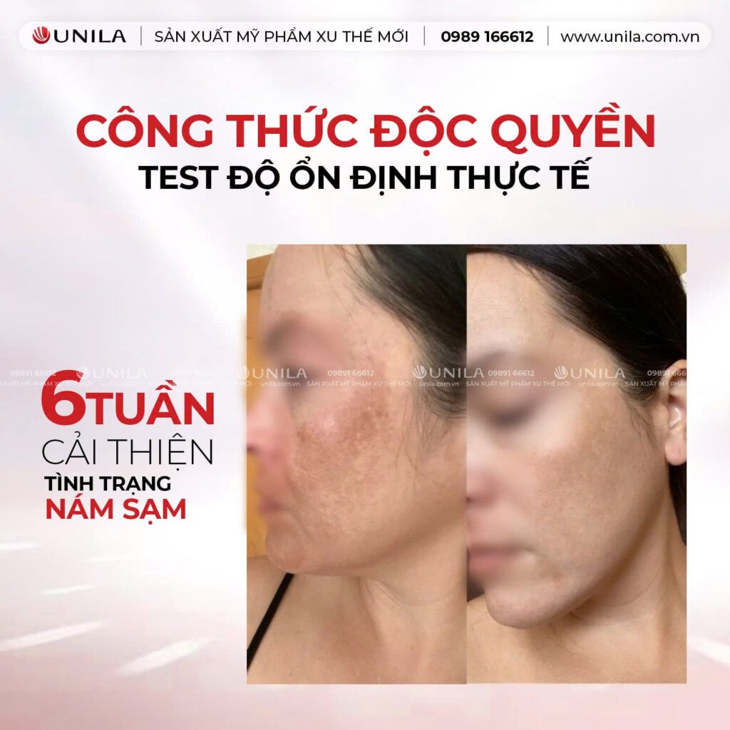 Thử nghiệm lâm sàn của nền kem siêu mịn mướt - Gia công mỹ phẩm UNILA